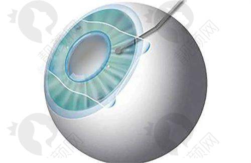 2025年西安佰视佳眼科的医生实力
