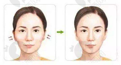 七、吉林大学第二医院医学美容科怎么预约：