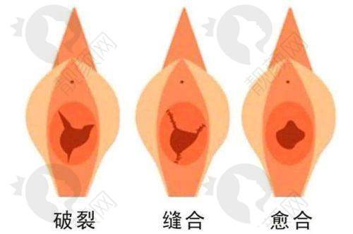 南京友谊整形外科医院：高难度整形，私密技术不错