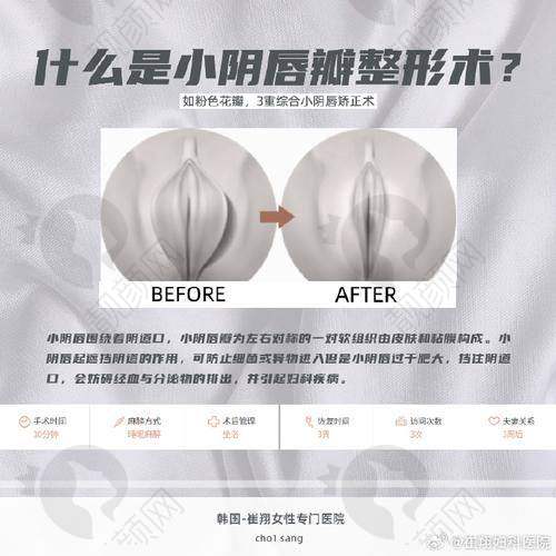南京京科医院女性私密中 心：新秀崛起，私密整形新势力