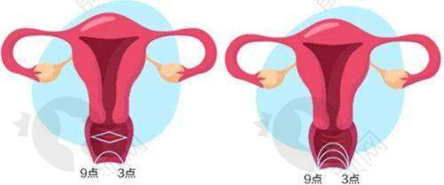 西安紧缩针哪里可以打？西安现代妇产医院美容科性价比高，疗效不错