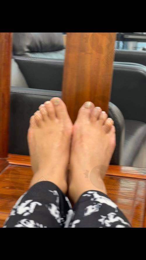 七、沈阳马文足科怎么预约：