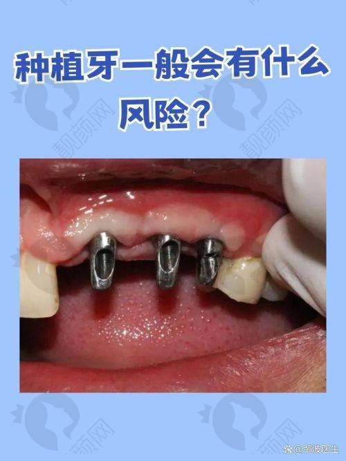 上海鼎植达奇怎么预约？