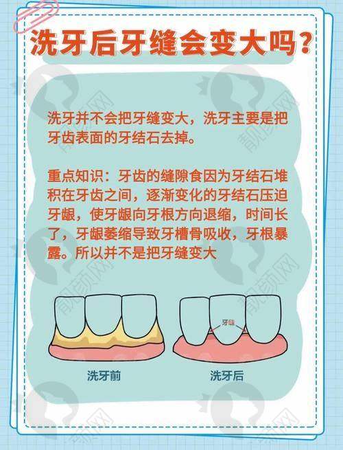 玉溪舒尔口腔医生洗牙价格50元起，优质服务、亲民价格开启口腔健康新体验！ 