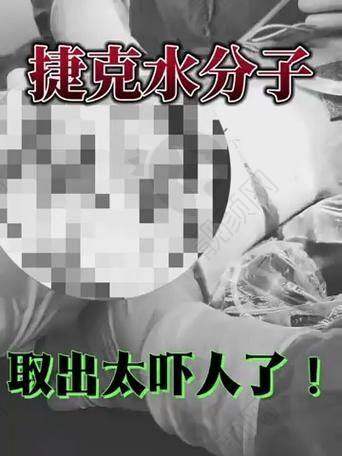 医疗美容：3D内窥镜助力，损伤小修复快