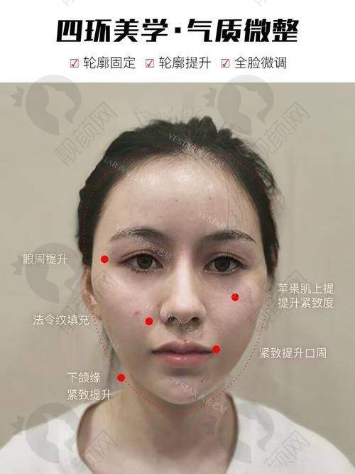 如何选择合适的医院