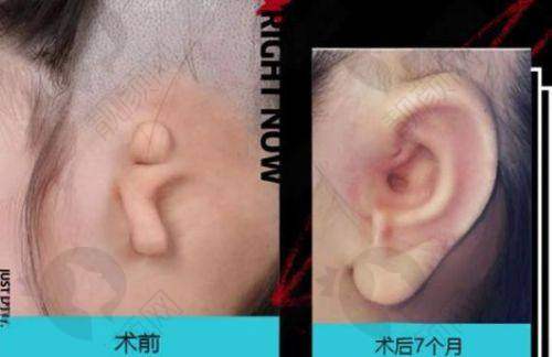 合肥壹加壹医疗美容医院:强大的医生团队