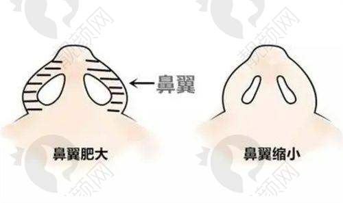 2025石家庄雅芳亚整形:口碑佳受认可