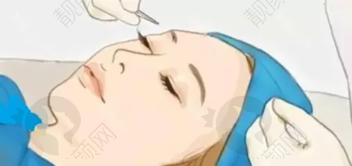 三、遵义利美康整形医院价格表:(仅供参考)