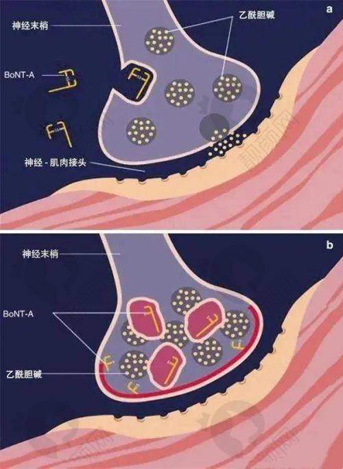 深圳美莱和富华哪个医院好?——热门项目大比拼