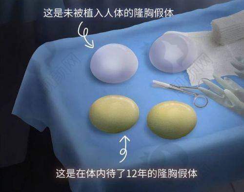 石家庄雅芳亚医疗美容医院:定制化丰胸的佼佼者
