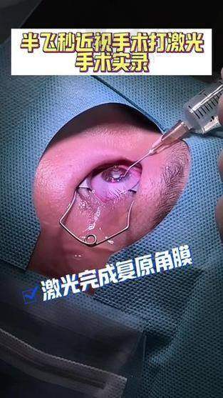 上海新视界眼科半飞秒：医生团队实力