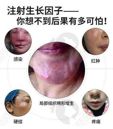 王阔远医生面部减容失败例子没有，收费1.5W起技术优，朝阳区西大望路口碑佳