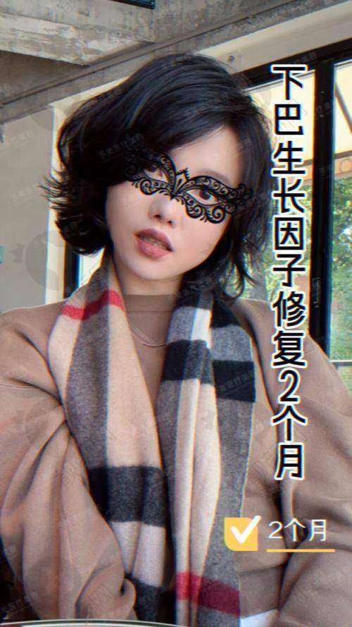 王阔远医生面部减容:收费1.5W起,性价比极高