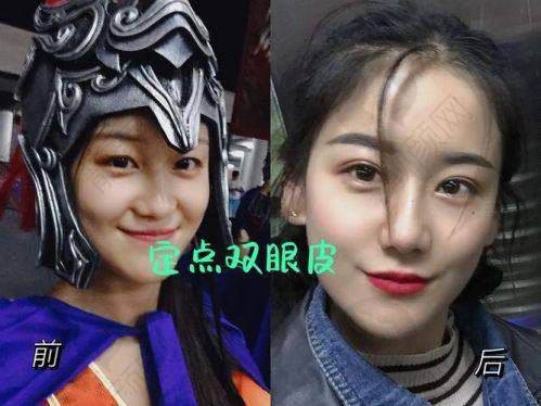 北京米兰柏羽丽都医疗美容做眼睛好医生曹卫华与于晓春:8度美瞳术的魅力