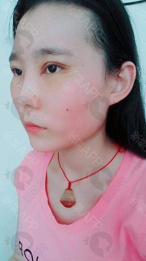 北京米兰柏羽丽都医疗美容做眼睛好医生曹卫华与于晓春:如何选择适合自己的医生