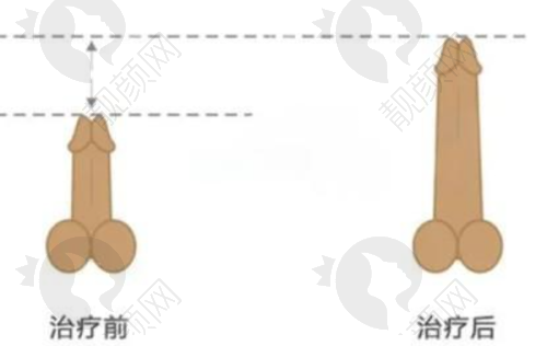 美牙项目