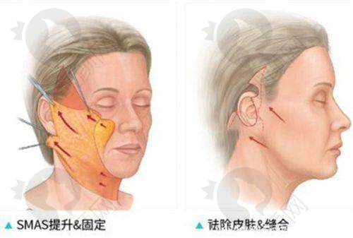 特色项目之数字化牙齿种植