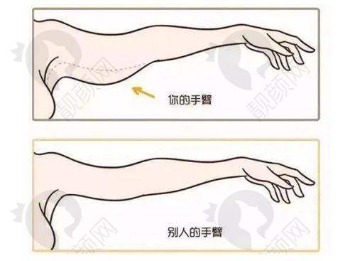 疤痕修复项目