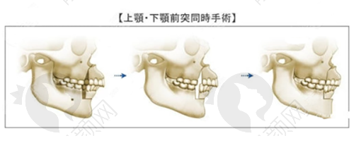 眼部整形项目