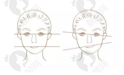 广州广美美妍医疗美容门诊部多项医美项目价格公布，双眼皮3800元起，美鼻6800元起