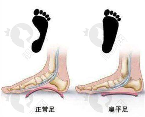 上海虹桥医院做拇外翻:电话预约享贴心服务