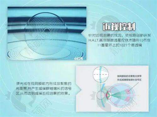 北京熙仁眼科医院的口碑评价:患者认可