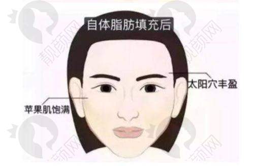 价格优势