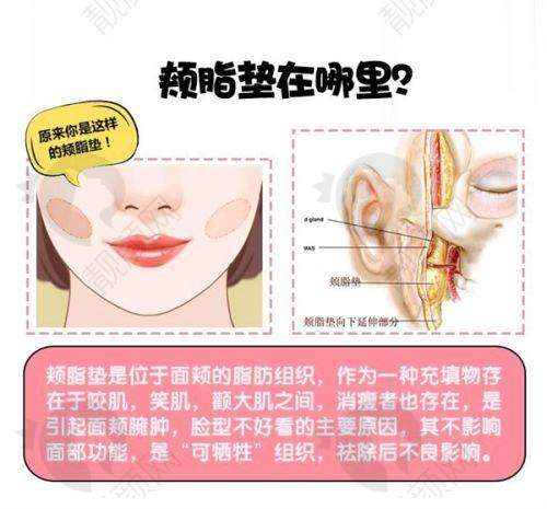 无托槽矫正项目