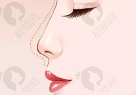 蚌埠德尔美客欣悦医疗美容门诊部双眼皮修复3000元起,微创眼袋价优,面部整形收费透明