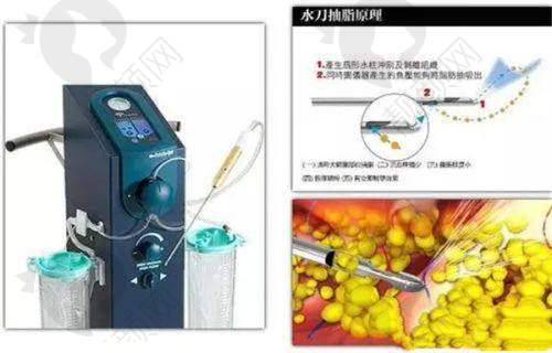 德州聚星整形医疗门诊部——正规专精,技术领跑开启变得更美之旅