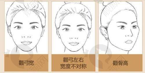 选择靠谱医院开启美丽之旅