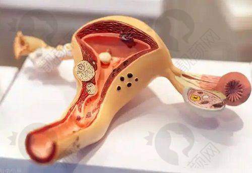 昆明艺星整形医院丰胸项目:多种选择满足需求