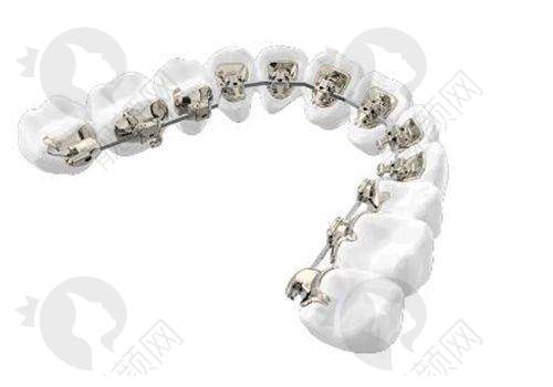 翟晓红口腔正畸实例