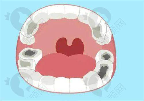 五、深圳尔睦口腔门诊部价格表:(仅供参考)