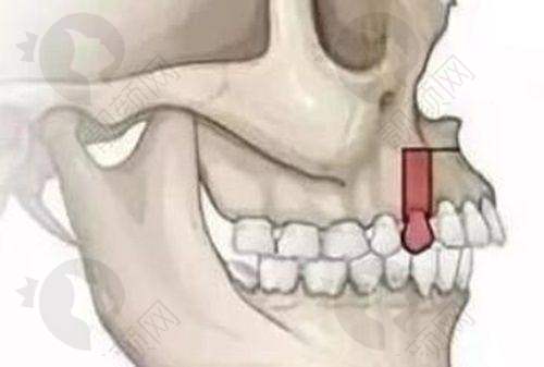 三、湘潭市中 心医院口腔科医生介绍: