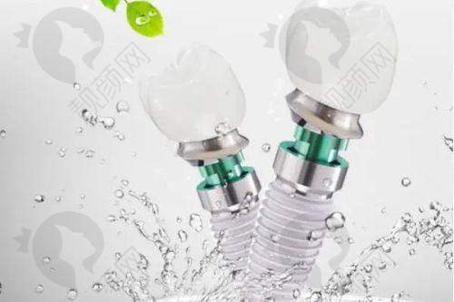 广州暨南雅皓口腔医院种牙优势尽显