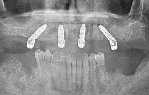 一、宁波鄞州德中口腔门诊部怎么样?