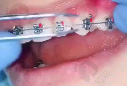 广州暨南雅皓口腔医院正畸特色突出