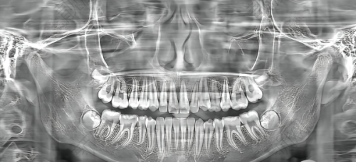 四、湘潭市中 心医院口腔科可以走医疗保险吗?