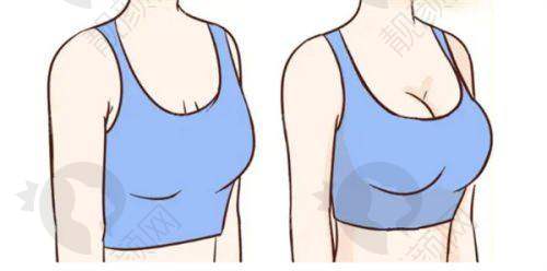 深圳福雅医疗做人中:不留疤超自然的秘诀