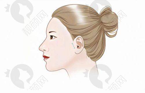 2025佳木斯整形医院排行榜年度名单揭晓！各医院技术口碑大揭秘，地址信息全掌握