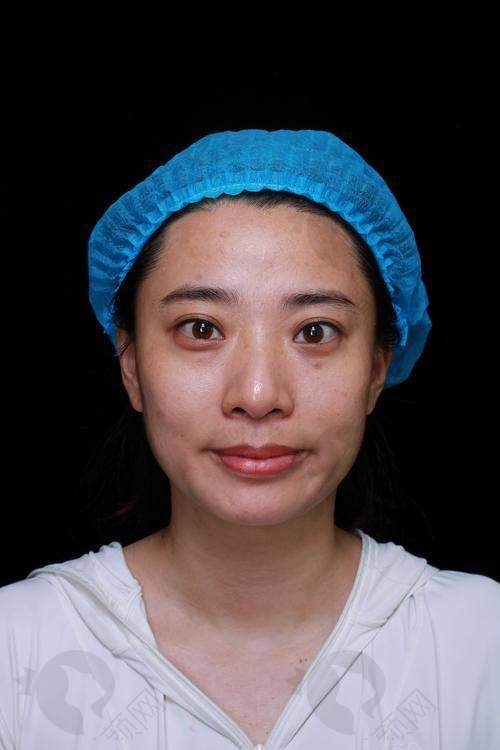 总结:哈尔滨去眼袋好的医院中,瑞丽、艺星、双燕等技术靠谱,口碑与价格优势超诱人!