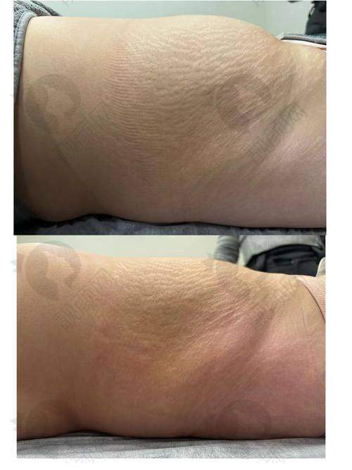 【曹孟君的医疗水平与口碑测评】已证实！深圳曹孟君医生技术靠谱口碑佳，多项整形项目值得信赖