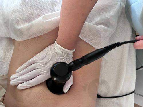 【曹孟君的医疗水平与口碑测评】已证实!真实患者反馈,选择理由充分