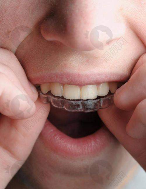 翟晓红项目价格表参考