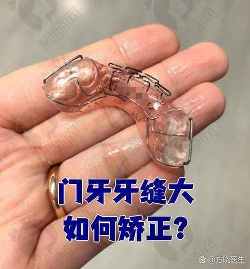 翟晓红在哪家医院