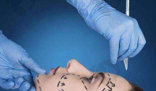 公布广州聂云飞在什么医院？聂深平面拉皮提升术超厉害，广州研媄荟口碑佳技术强！