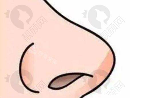 北京美莱医疗美容医院韩式生科隆鼻的优势