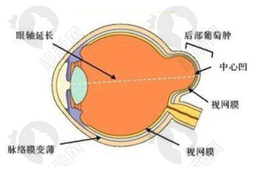 武汉爱尔眼科医院各分院地址及特色